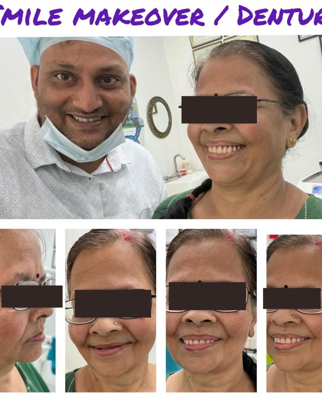 All-on-6 Dental Implants / Full Mouth Rehablitaiton - photo 1